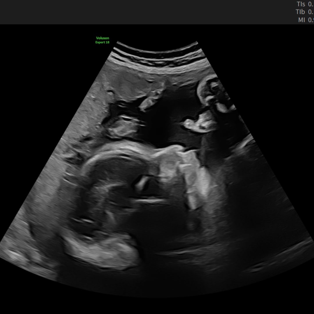 Photo shared by Rebecca for their Babylist baby registry.