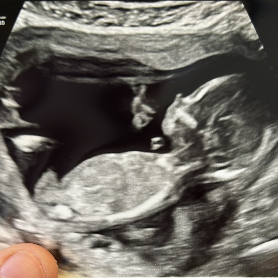 Photo shared by Bailey for their Babylist baby registry.