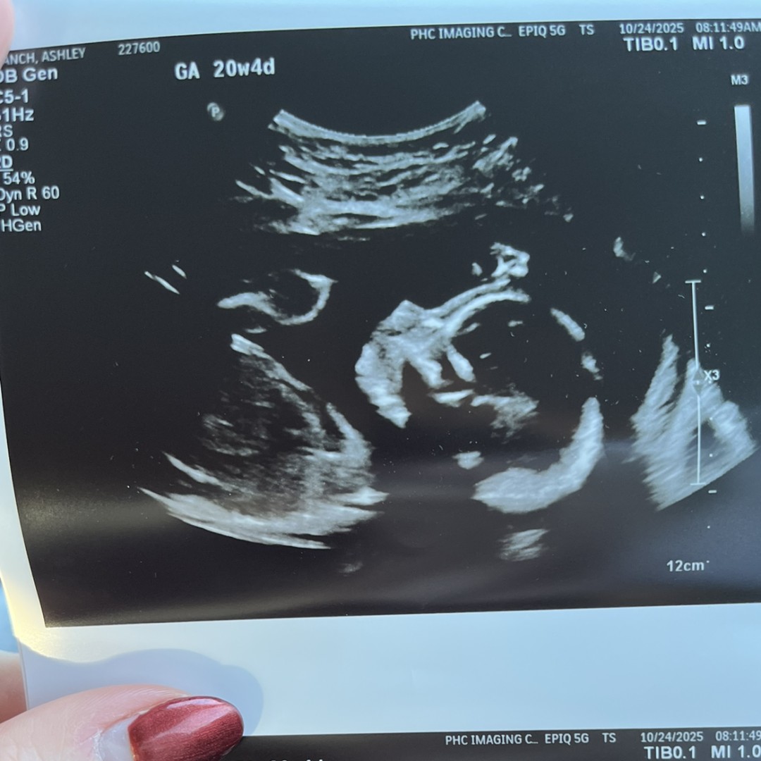 Photo shared by Ashley for their Babylist baby registry.