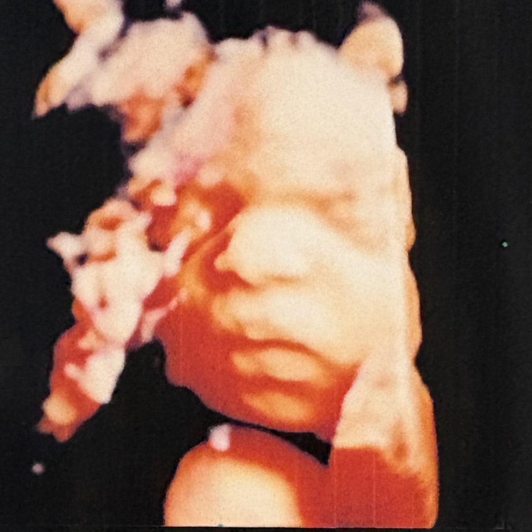 Photo shared by Amari for their Babylist baby registry.