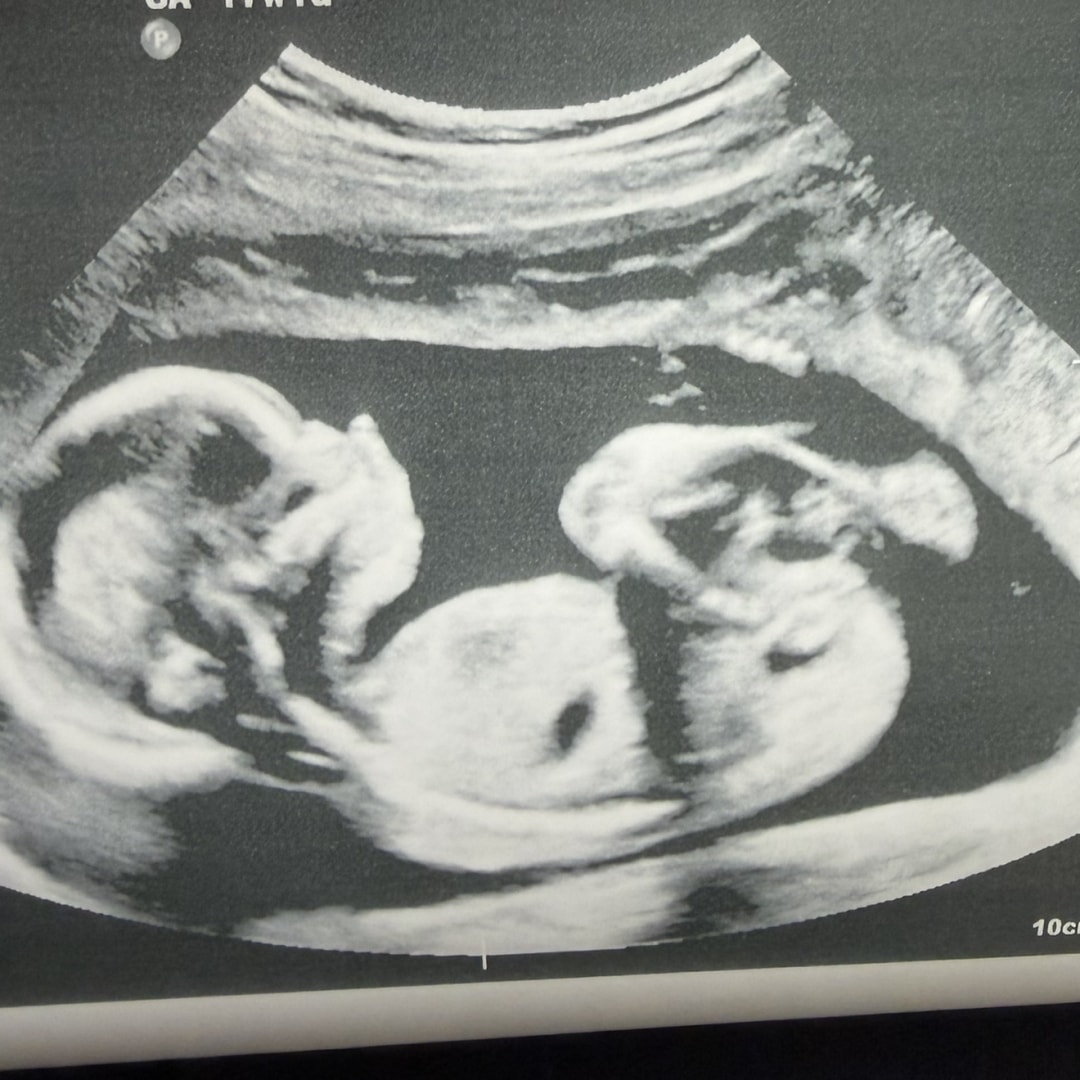 Photo shared by Romero for their Babylist baby registry.