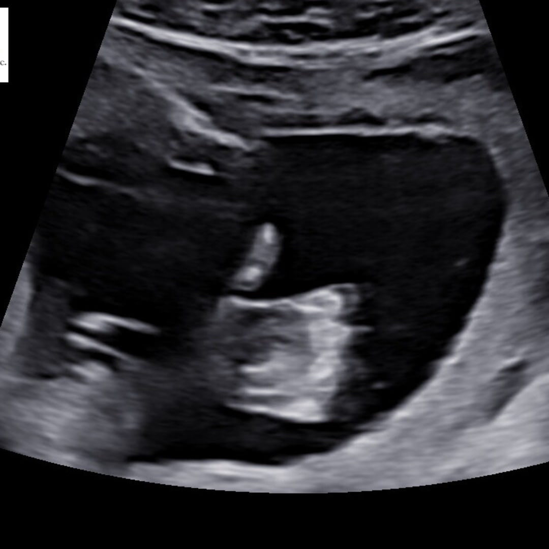 Photo shared by Emily for their Babylist baby registry.