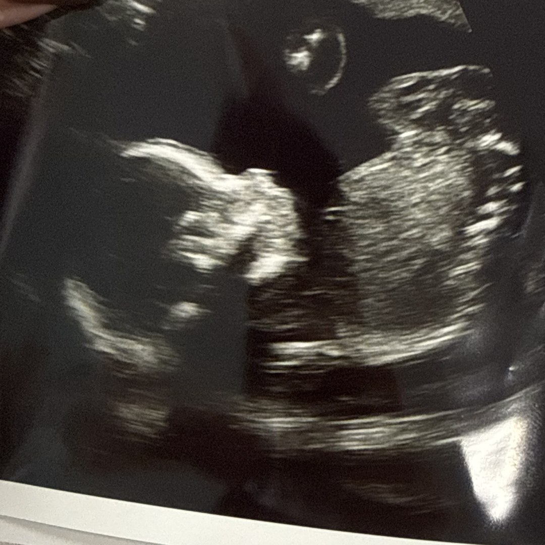 Photo shared by Kendra for their Babylist baby registry.