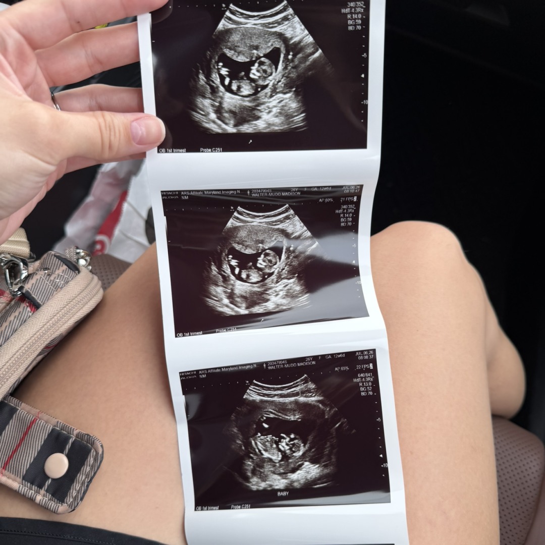 Photo shared by Madison for their Babylist baby registry.