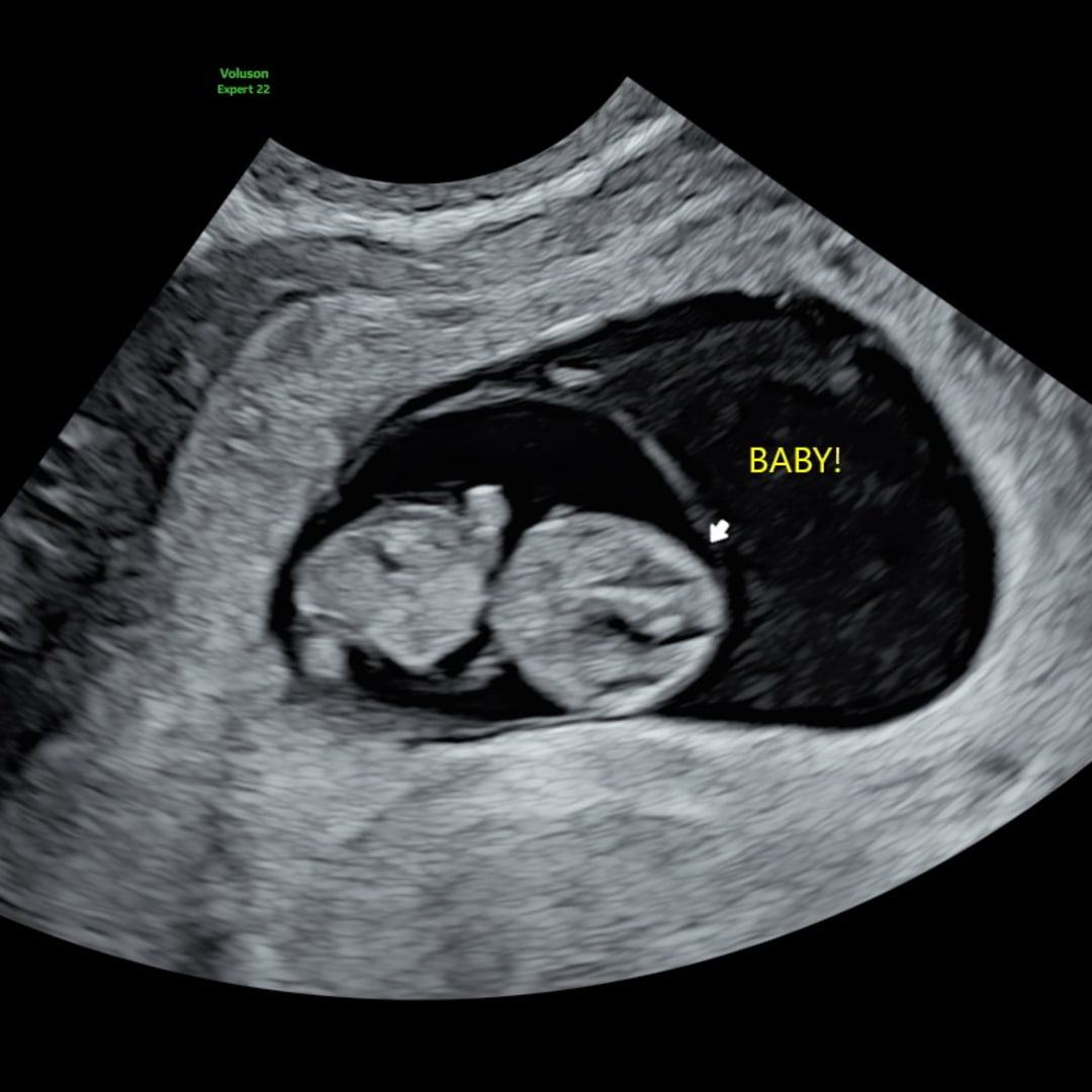 Photo shared by Zaina for their Babylist baby registry.