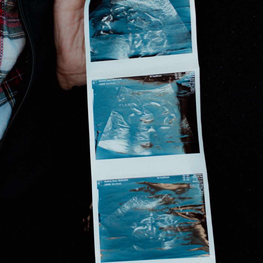 Photo shared by Valeri for their Babylist baby registry.