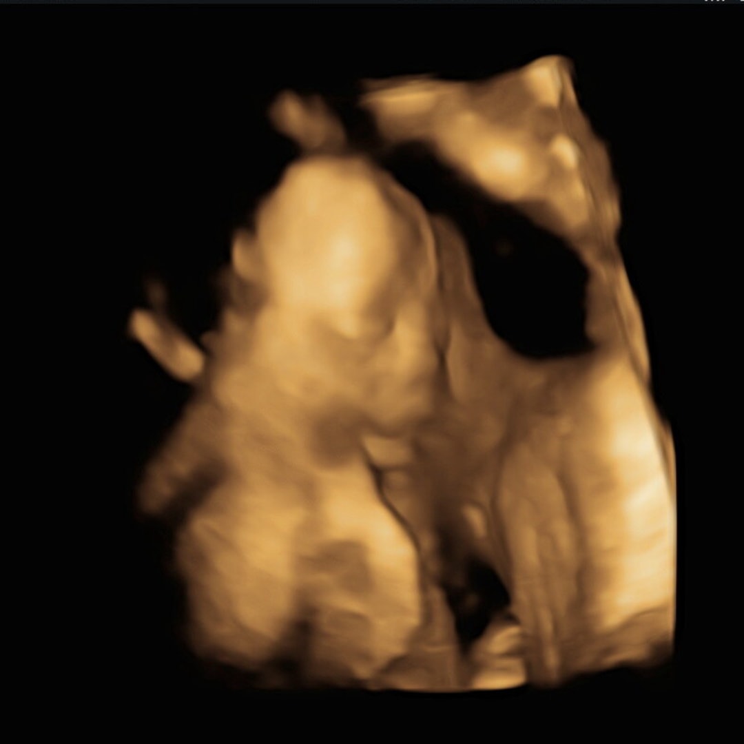 Photo shared by Zoe for their Babylist baby registry.