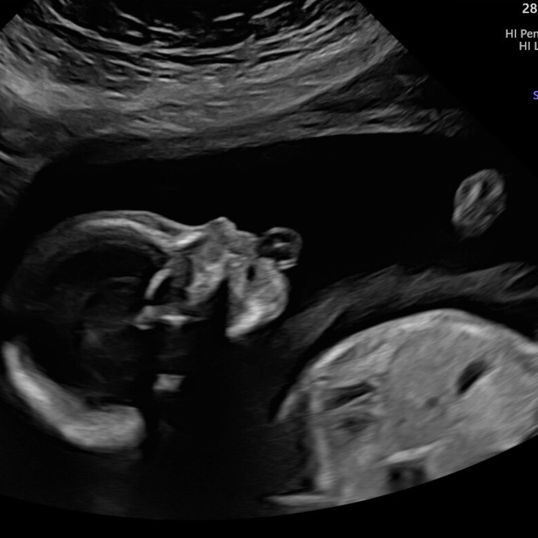 Photo shared by Carly for their Babylist baby registry.