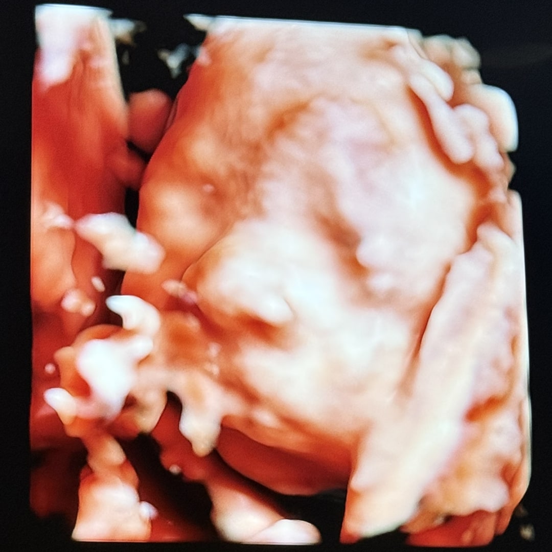 Photo shared by Ashlynn for their Babylist baby registry.