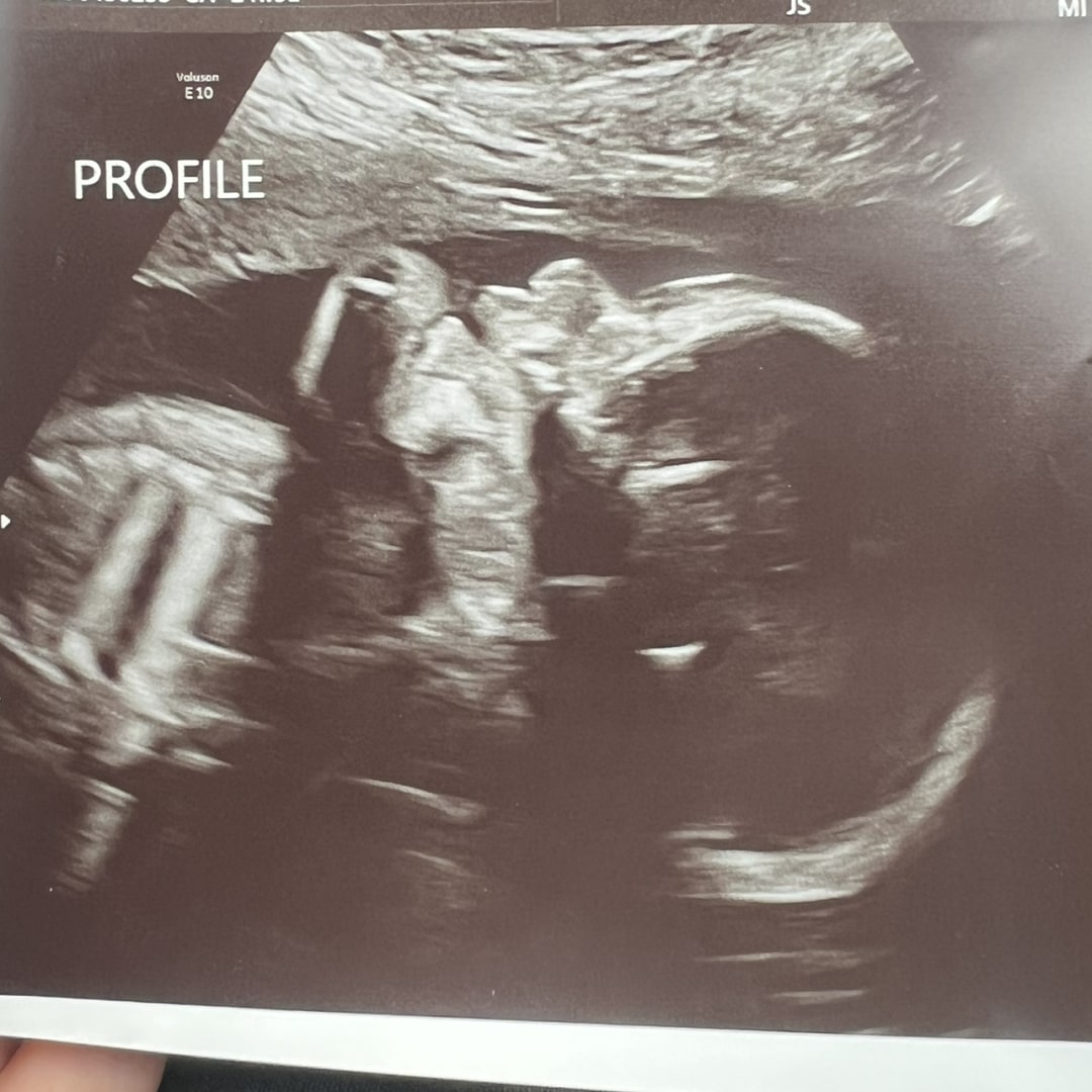 Photo shared by McKenzie for their Babylist baby registry.