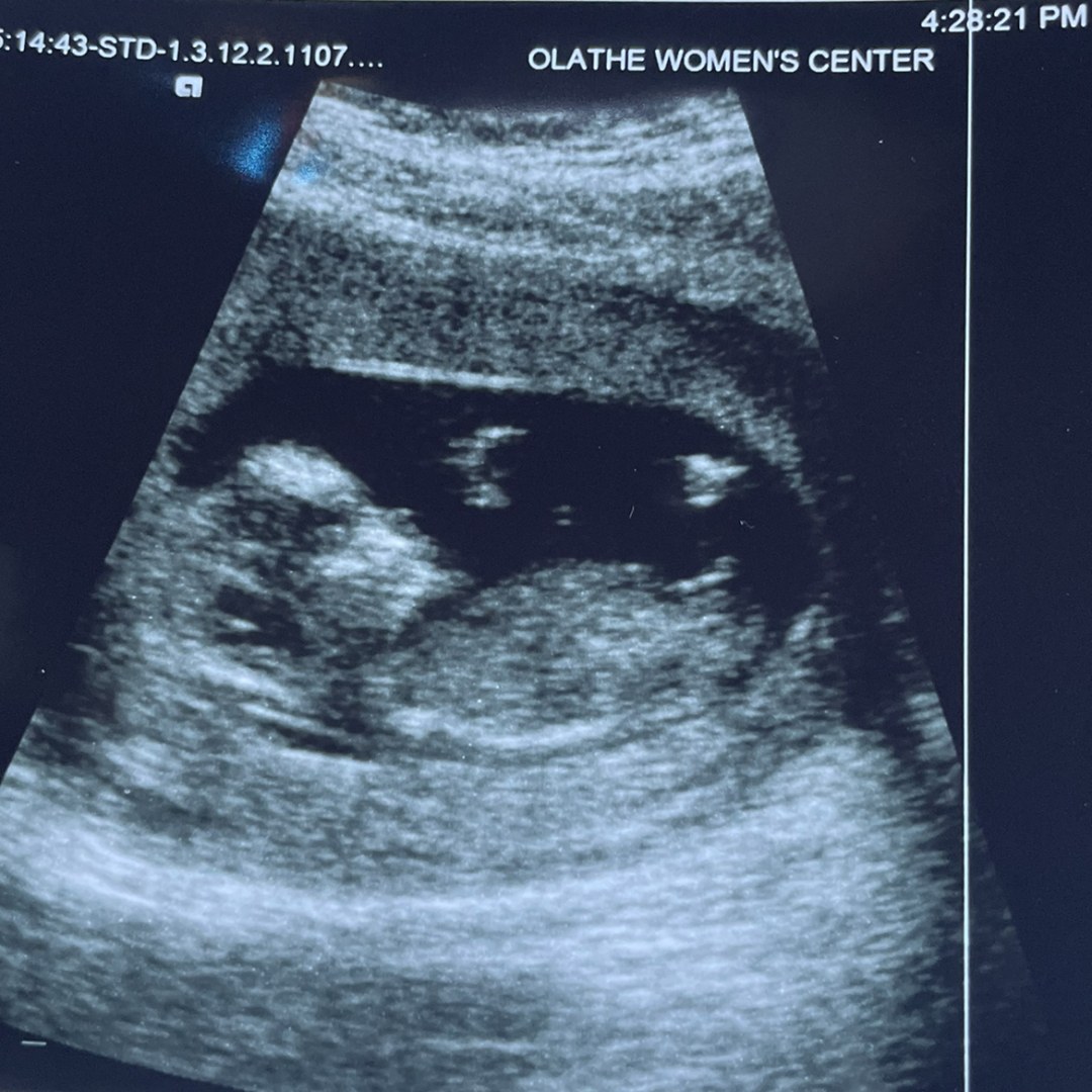 Photo shared by Allie for their Babylist baby registry.