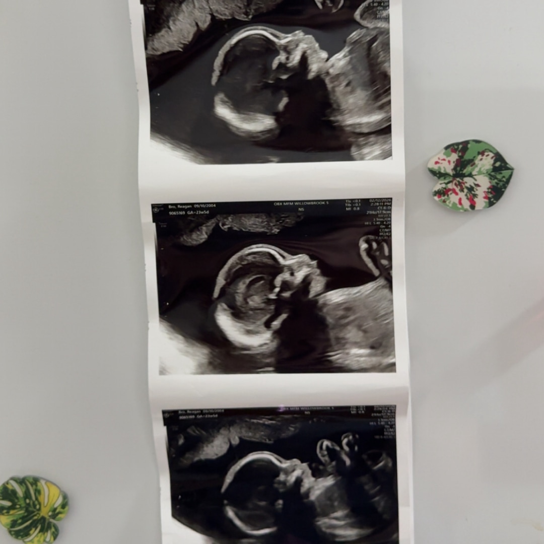 Photo shared by Reagan for their Babylist baby registry.