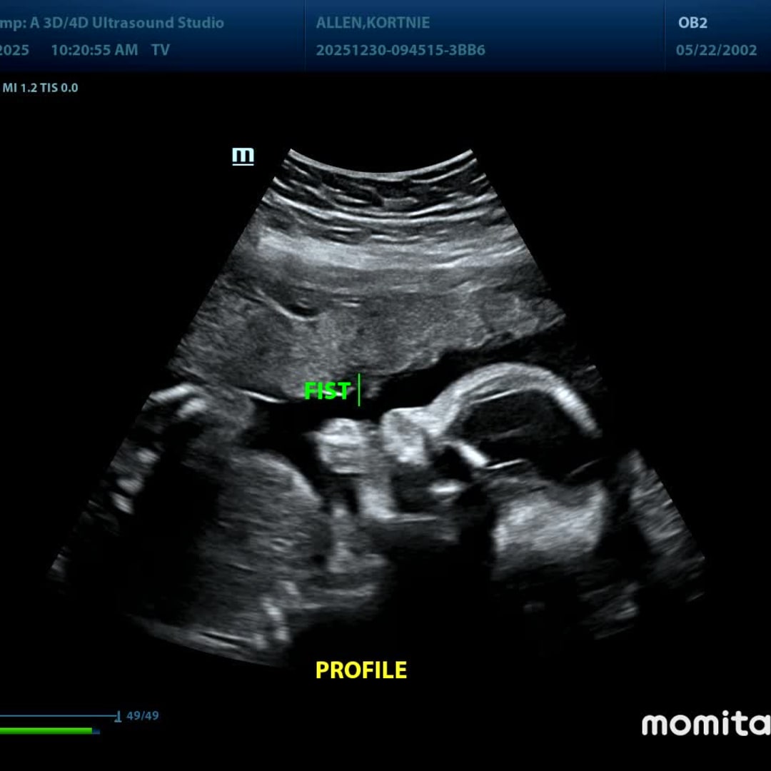 Photo shared by Kortnie for their Babylist baby registry.