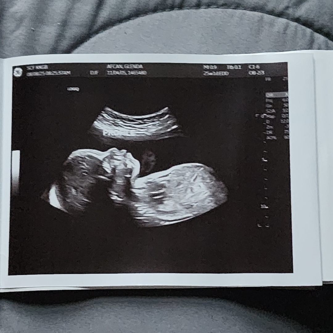 Photo shared by Glenda for their Babylist baby registry.