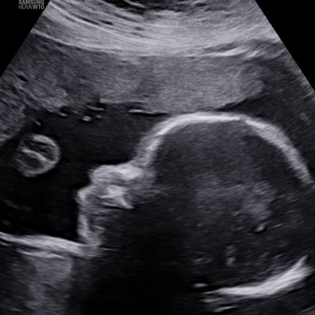 Photo shared by Leandra for their Babylist baby registry.