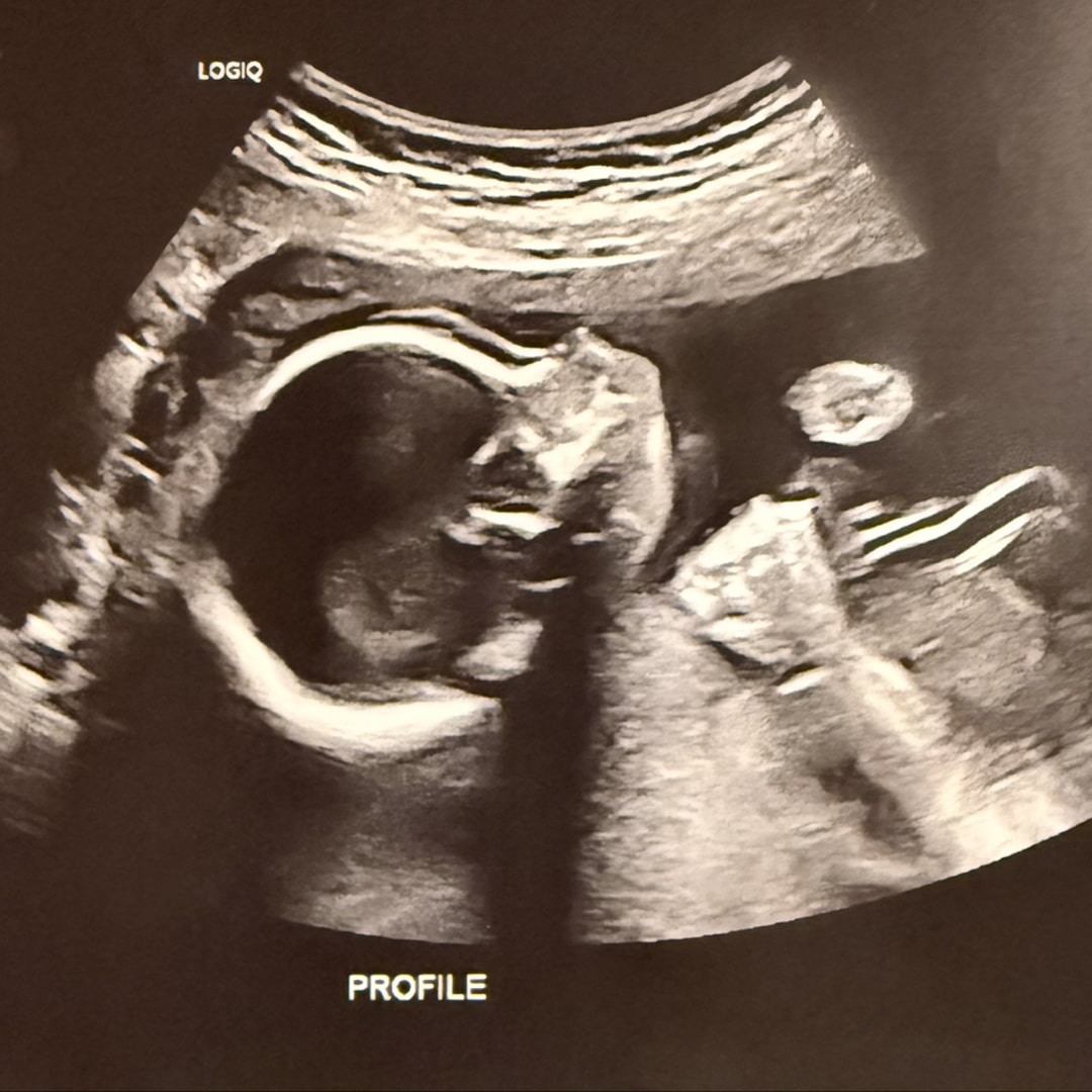 Photo shared by Holly for their Babylist baby registry.