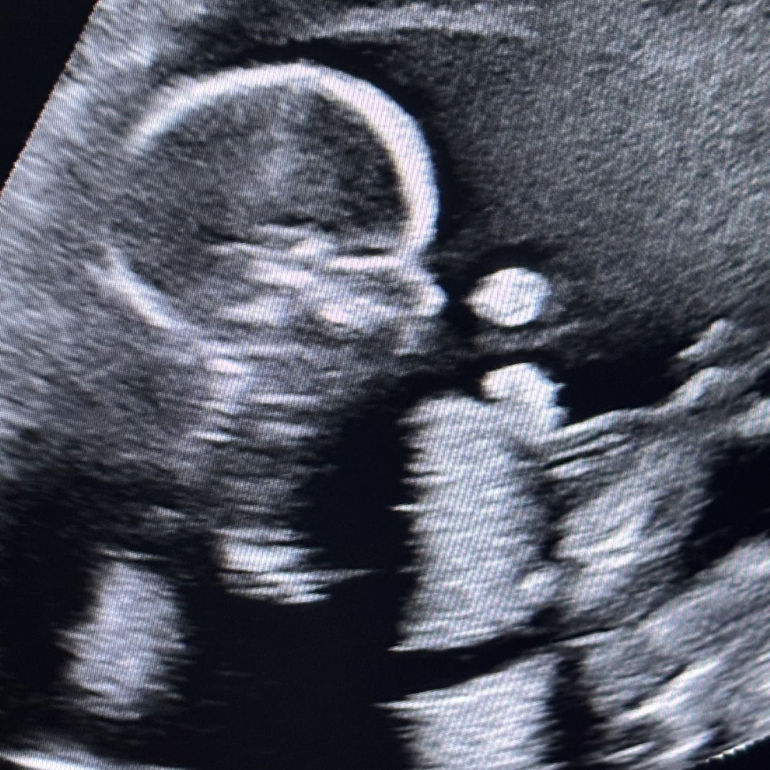 Photo shared by Bethani for their Babylist baby registry.