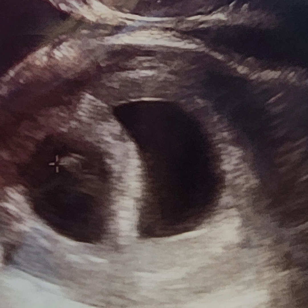 Photo shared by Hannah for their Babylist baby registry.