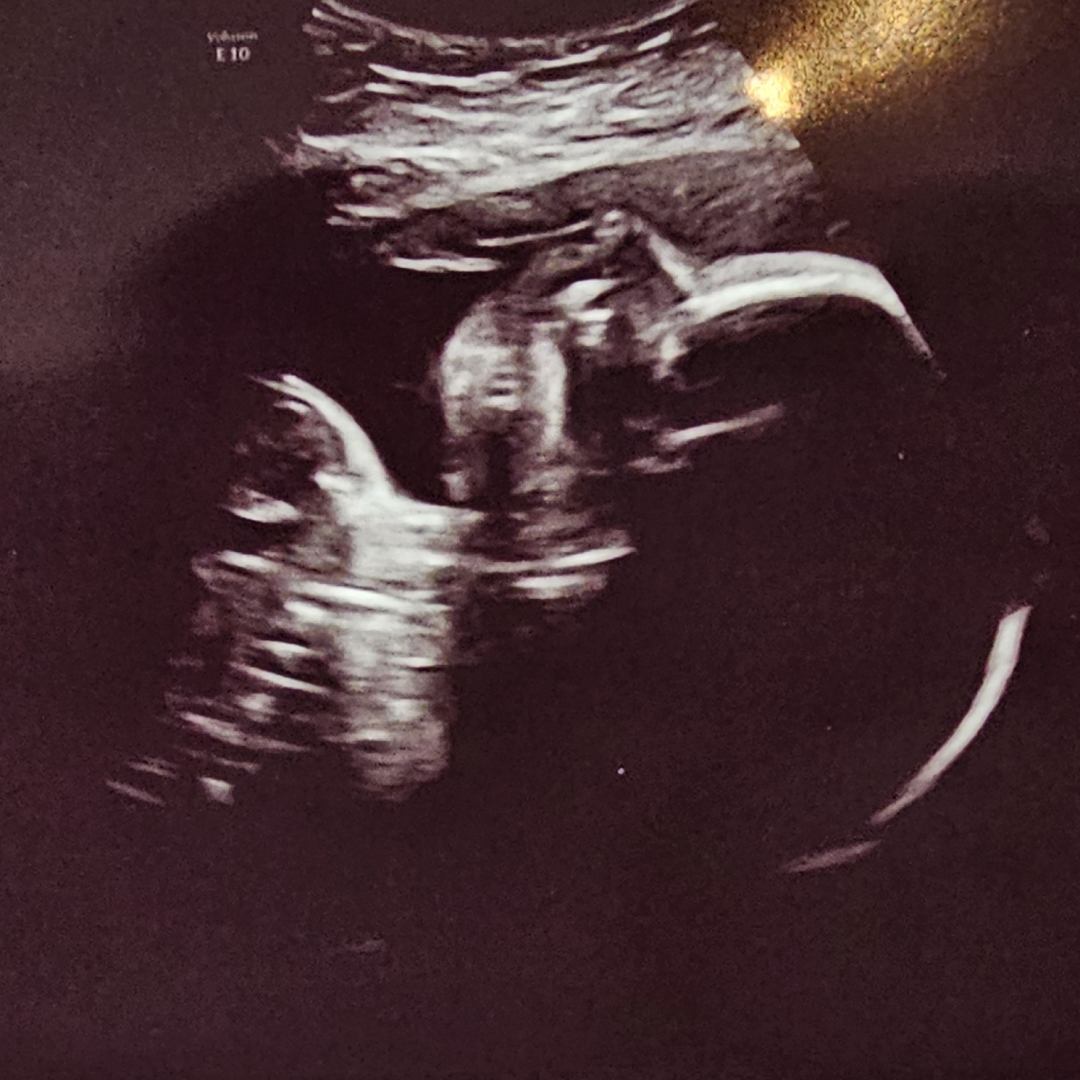 Photo shared by Katie for their Babylist baby registry.