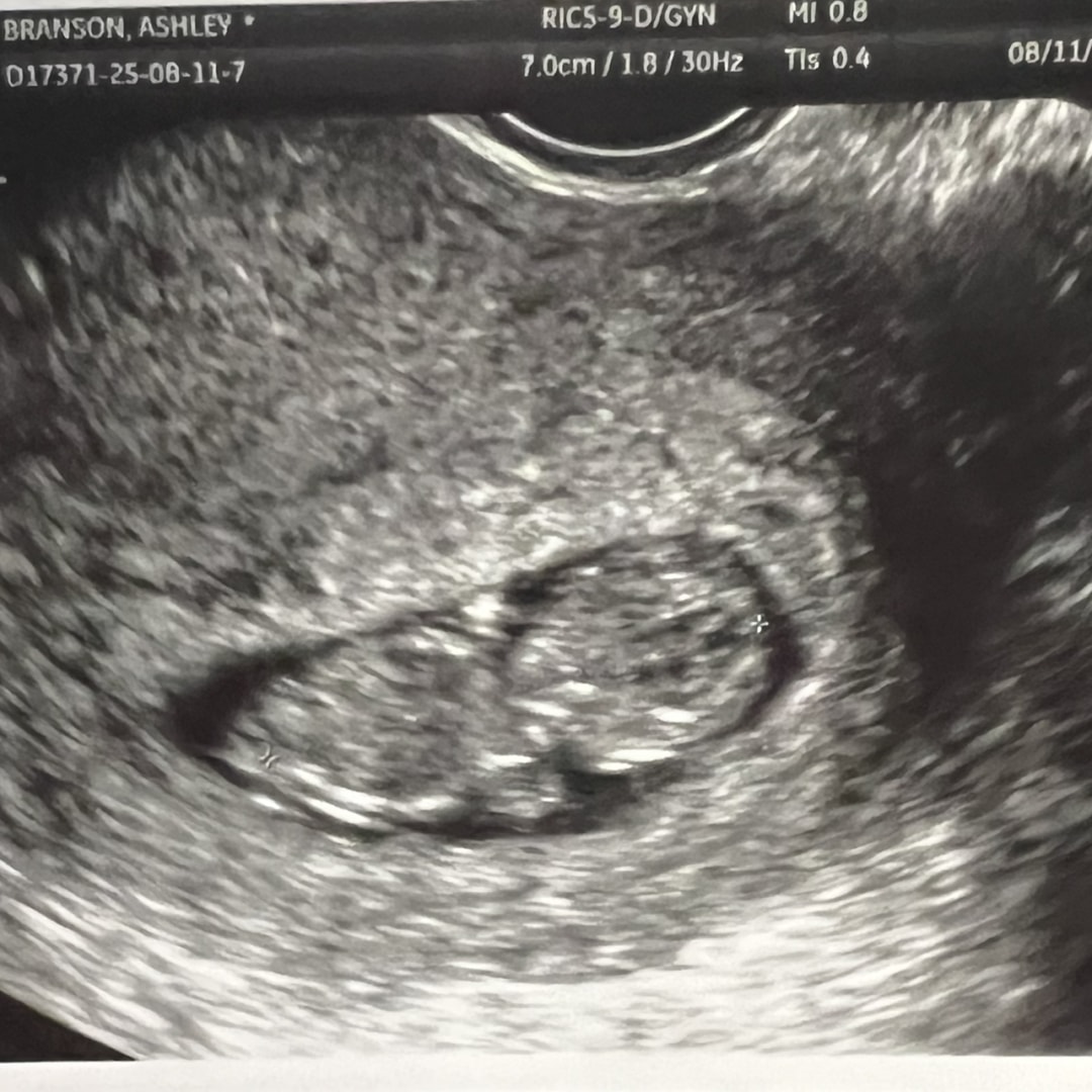 Photo shared by Ashley for their Babylist baby registry.