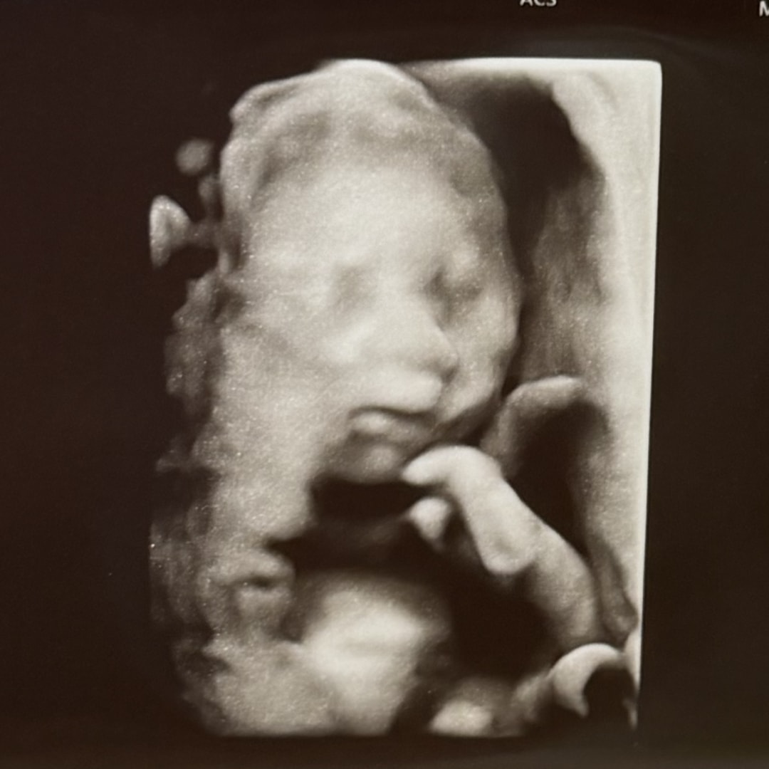 Photo shared by Kennedy for their Babylist baby registry.