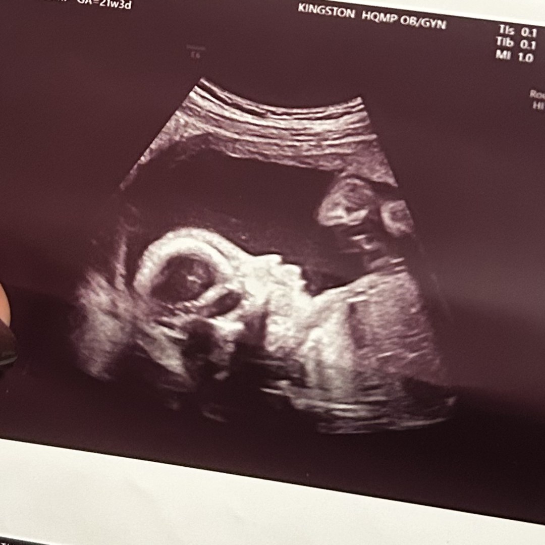 Photo shared by Dainna for their Babylist baby registry.