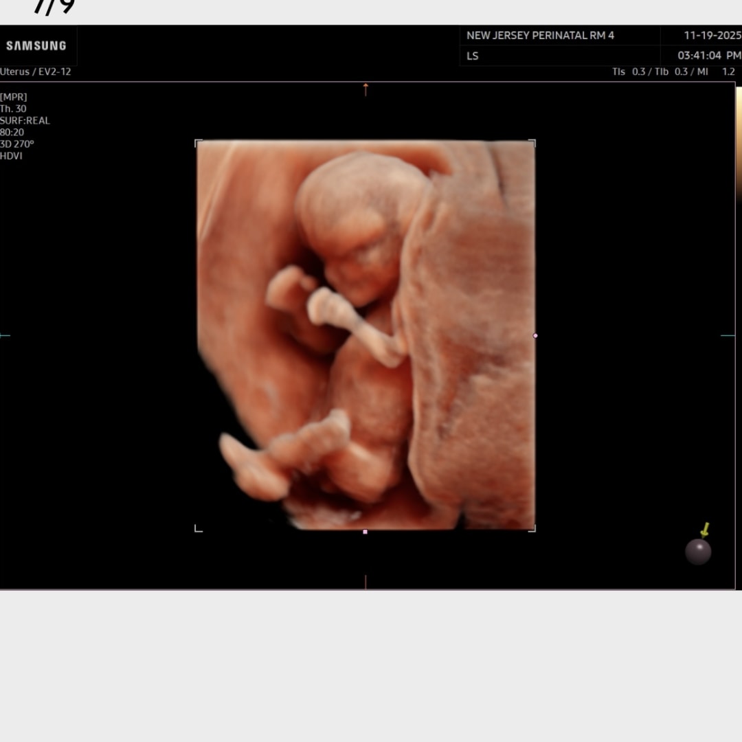 Photo shared by Rachel for their Babylist baby registry.