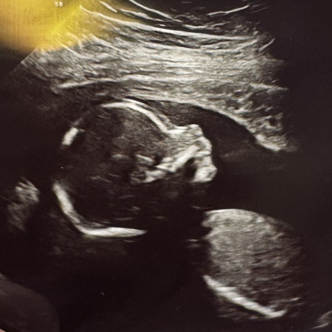 Photo shared by Adeline for their Babylist baby registry.