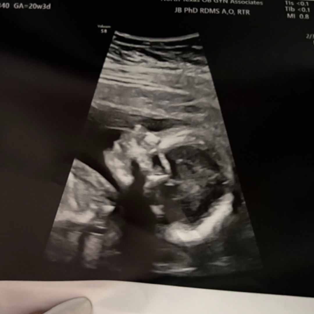 Photo shared by Carolina for their Babylist baby registry.