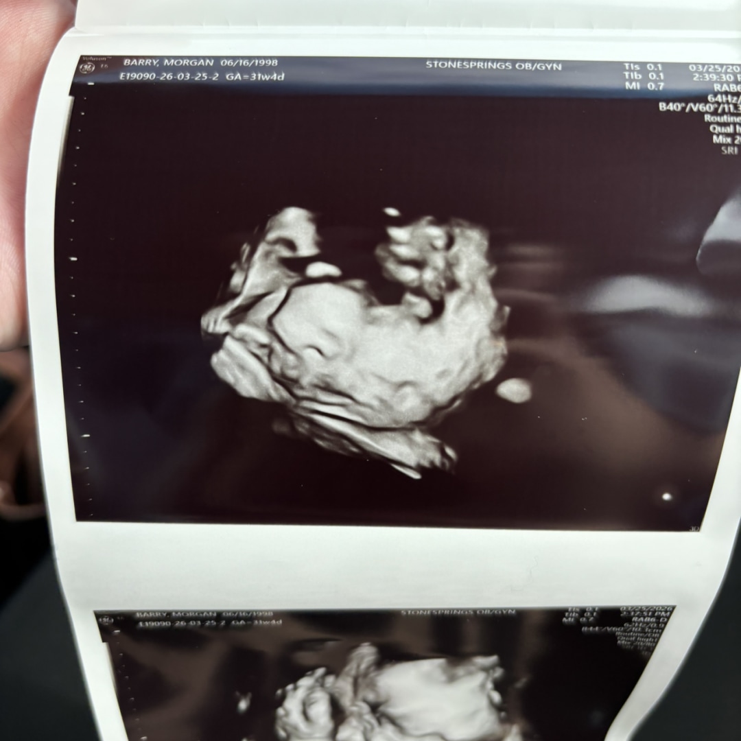 Photo shared by Morgan for their Babylist baby registry.