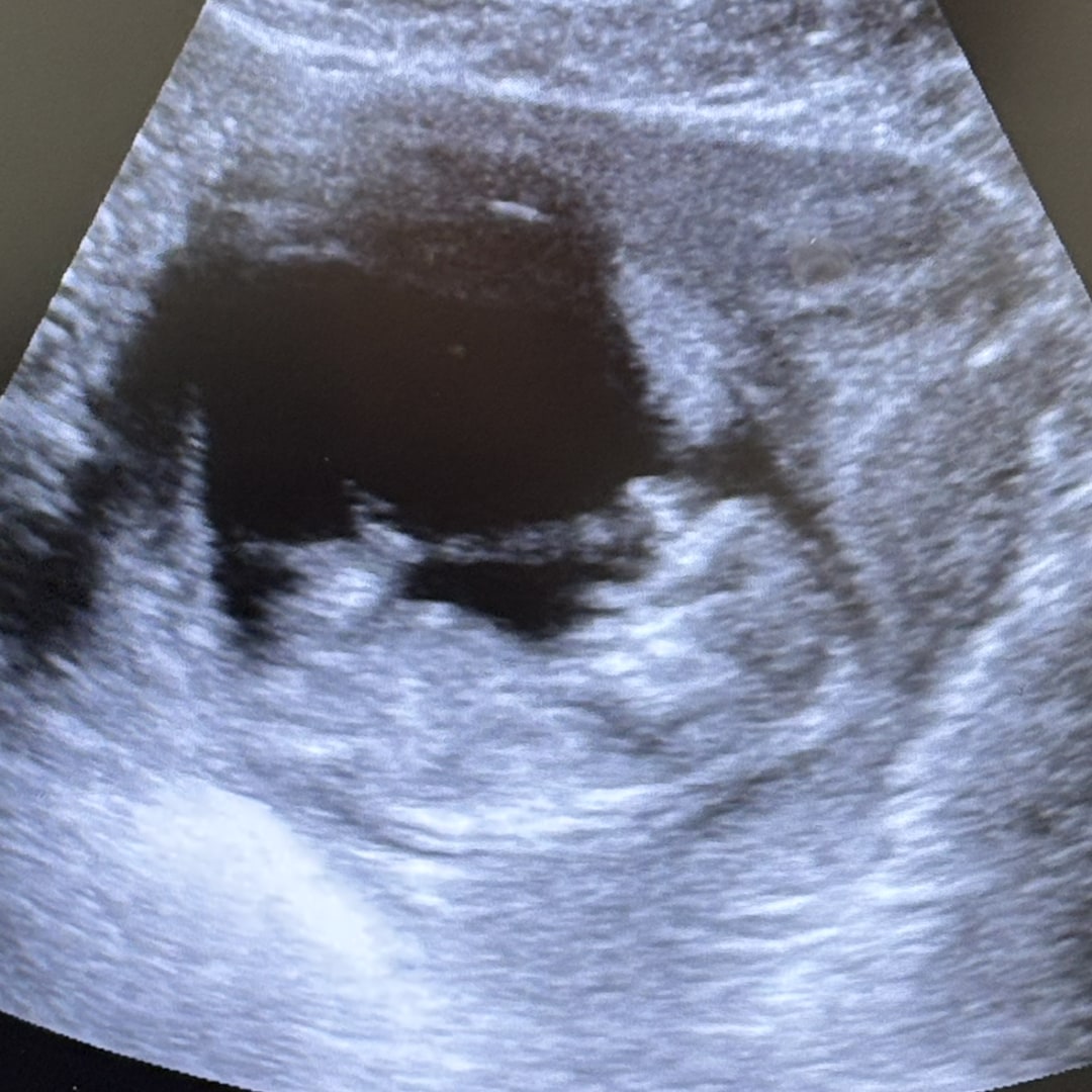 Photo shared by Katie for their Babylist baby registry.