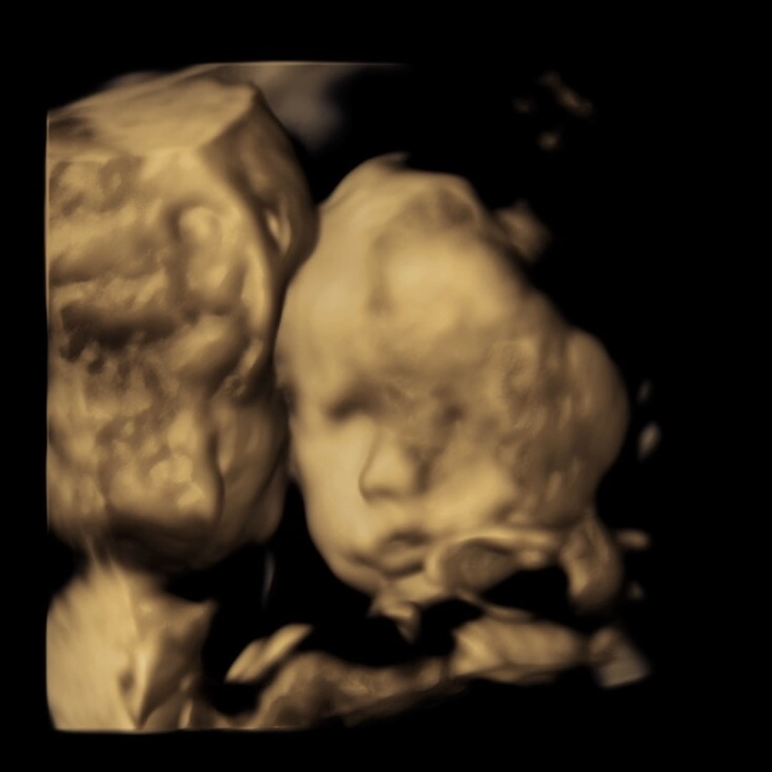 Photo shared by Sarah for their Babylist baby registry.