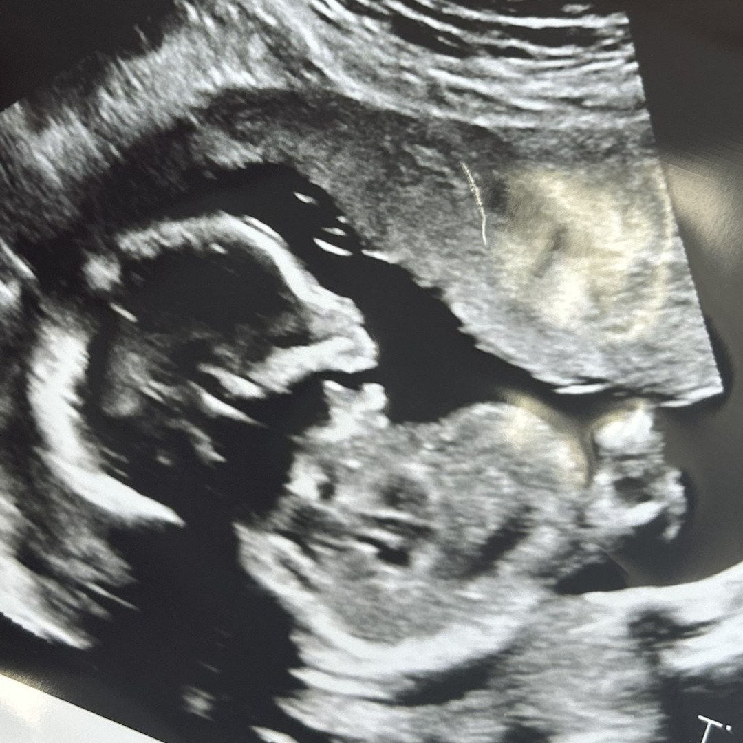 Photo shared by Jackie for their Babylist baby registry.