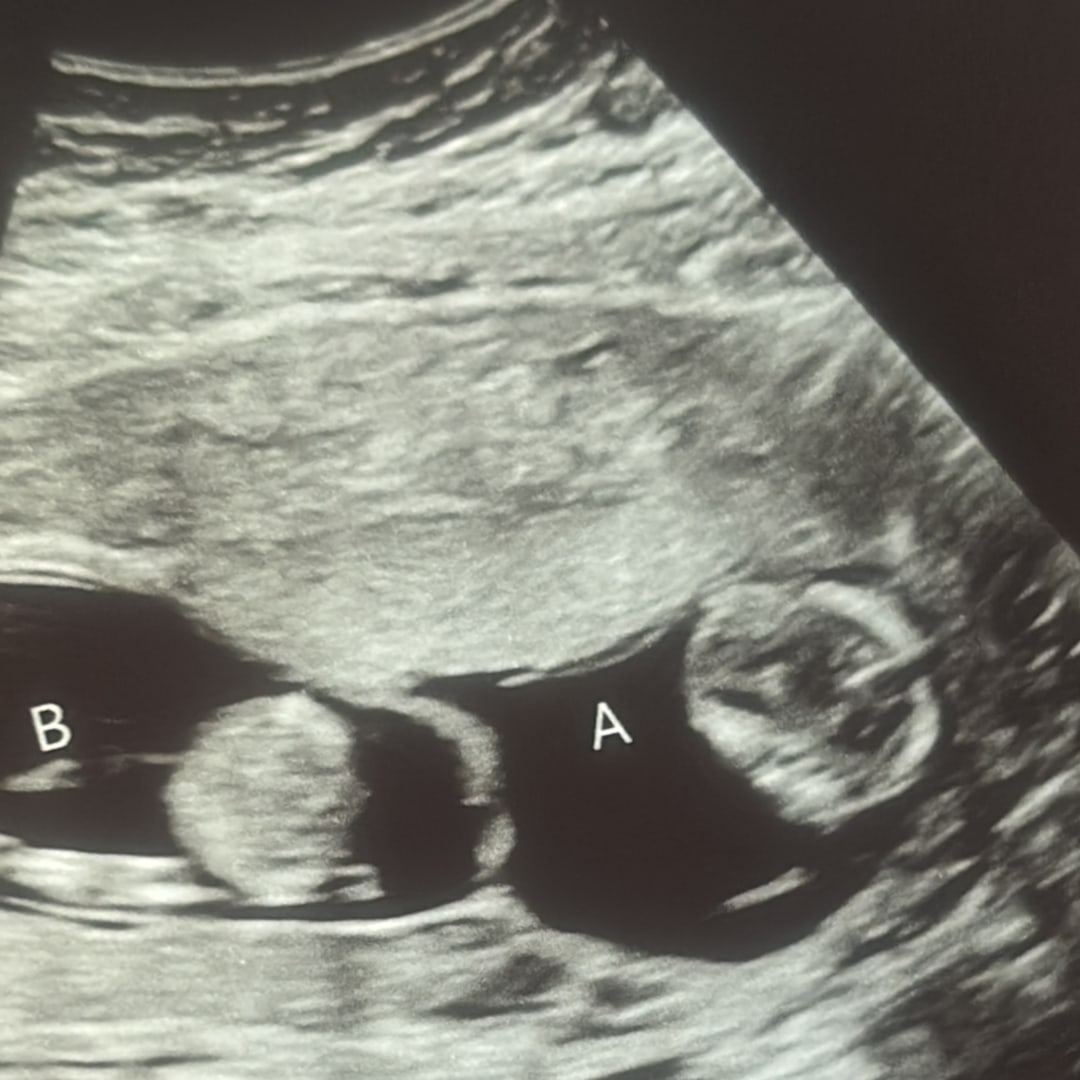 Photo shared by Barbara for their Babylist baby registry.