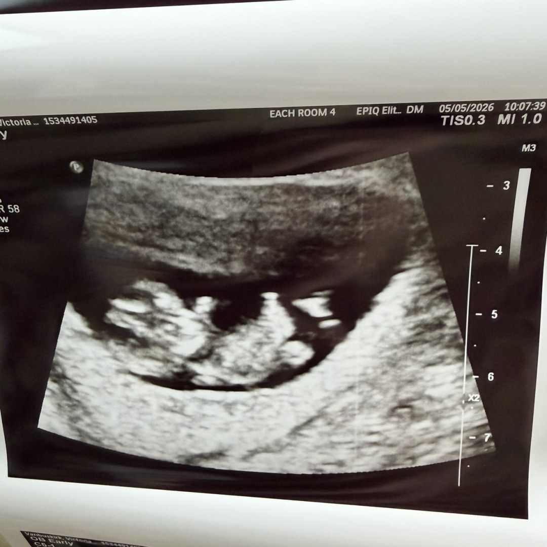 Photo shared by Victoria for their Babylist baby registry.