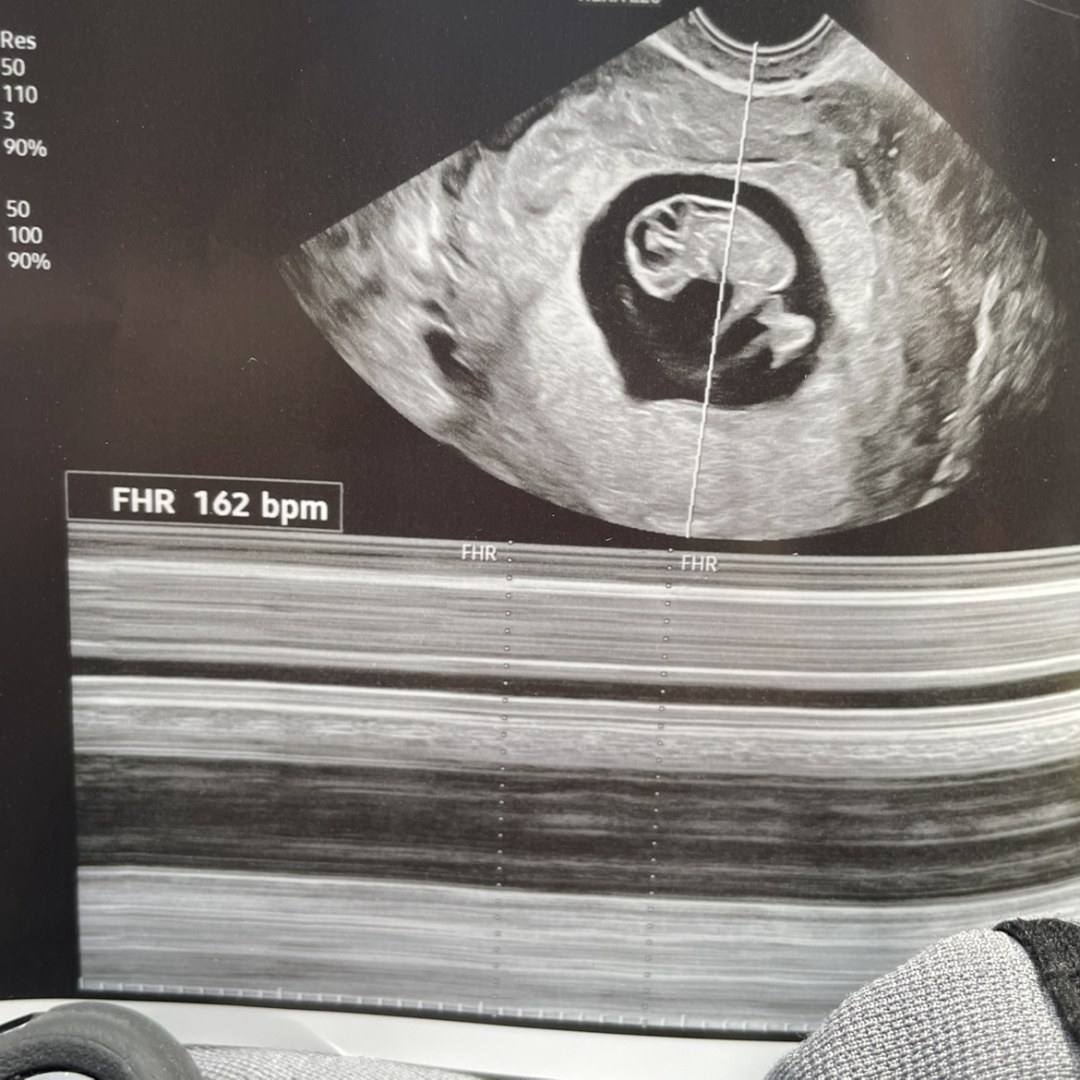 Photo shared by Tiffiny for their Babylist baby registry.