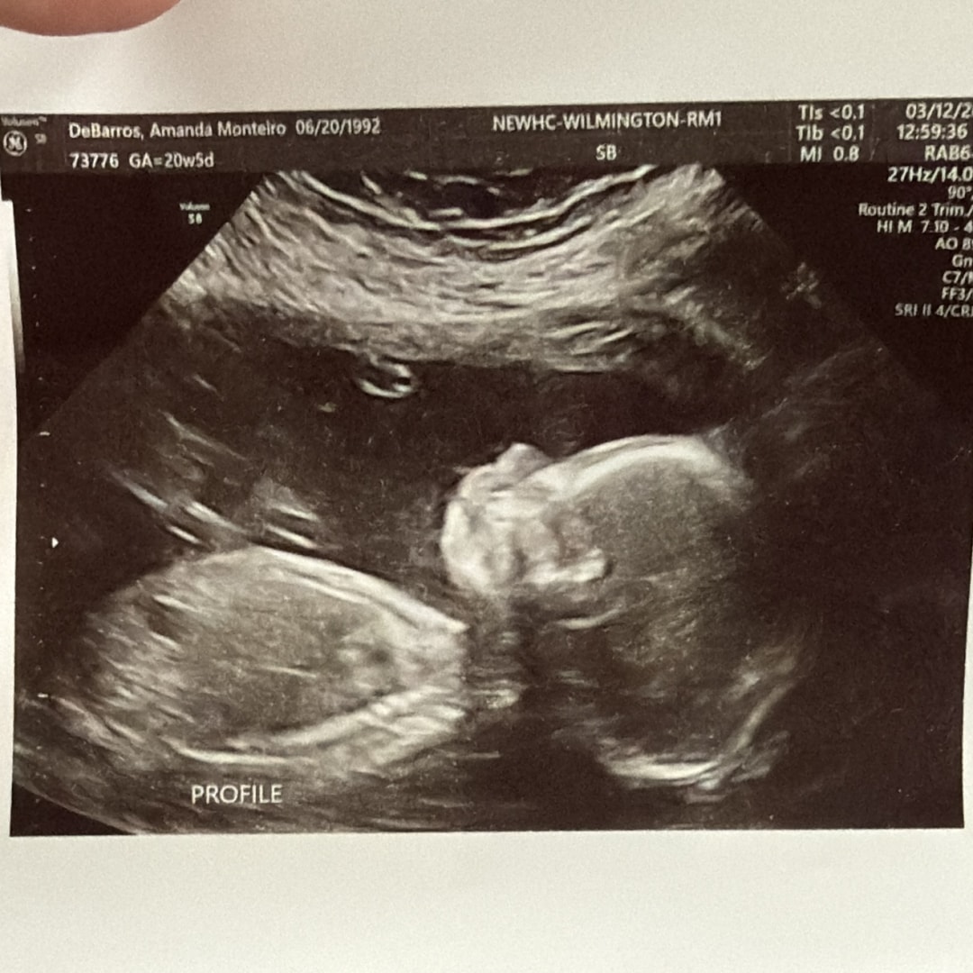 Photo shared by Amanda for their Babylist baby registry.