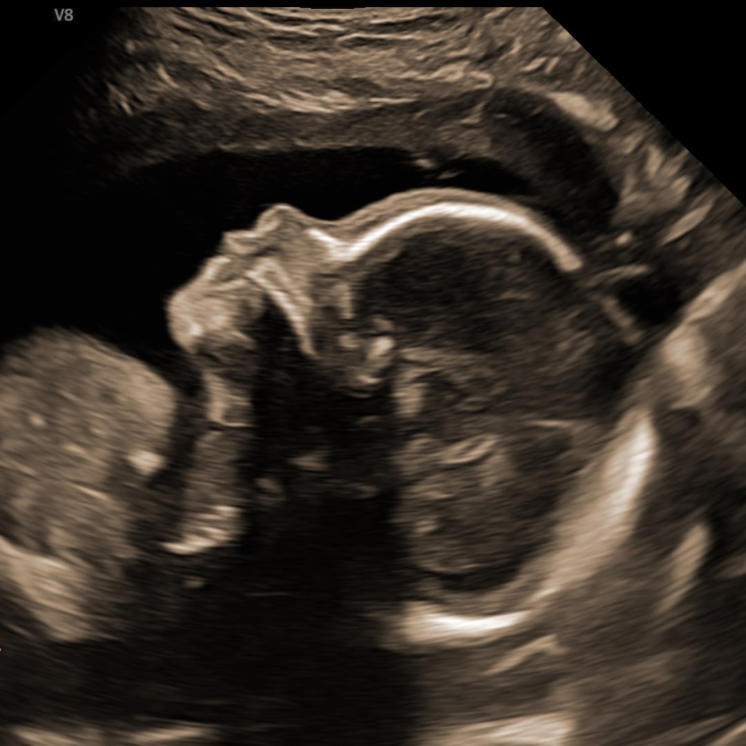 Photo shared by Alyson for their Babylist baby registry.