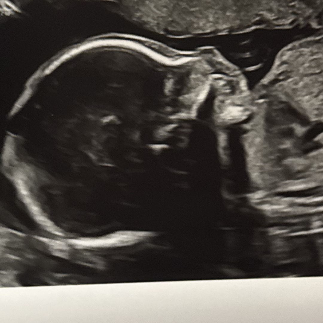 Photo shared by Kelly for their Babylist baby registry.