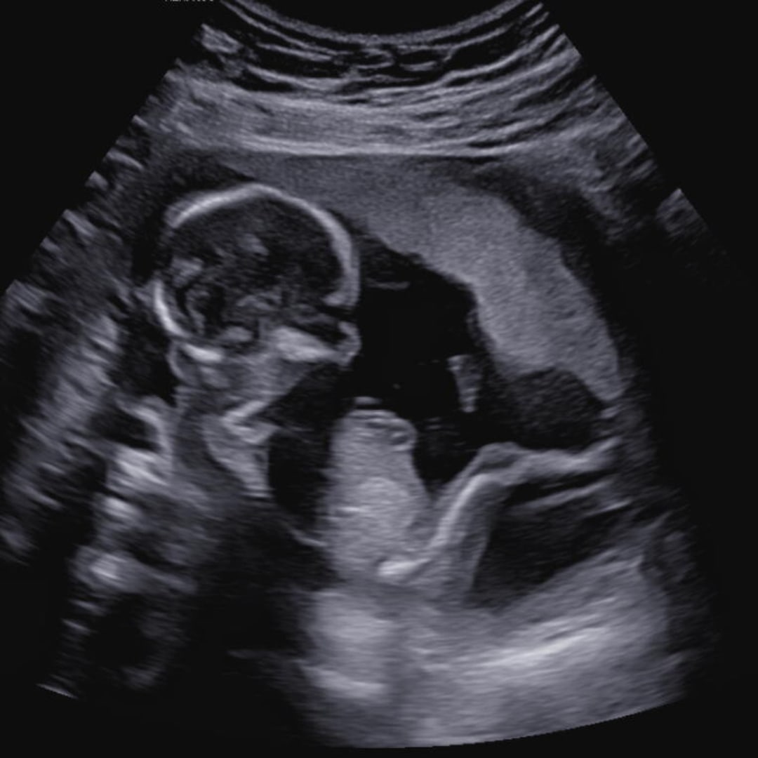 Photo shared by Samantha for their Babylist baby registry.