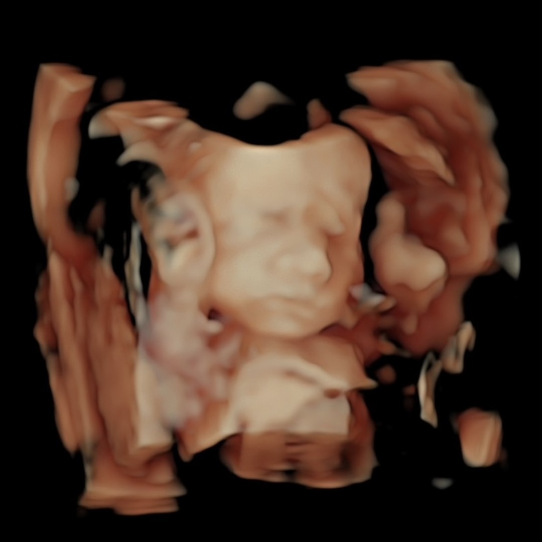Photo shared by Chastity for their Babylist baby registry.