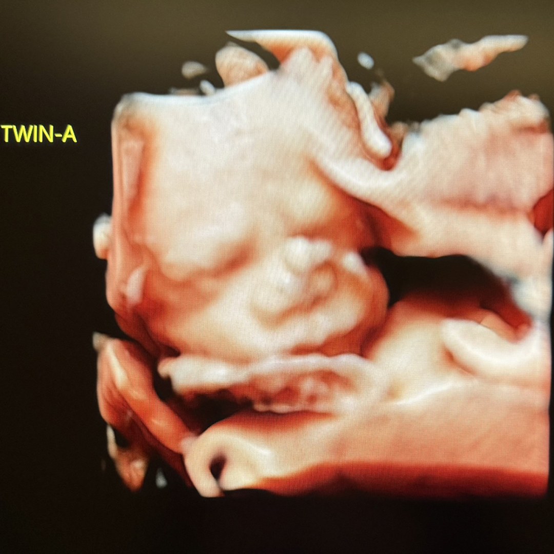 Photo shared by Carol for their Babylist baby registry.