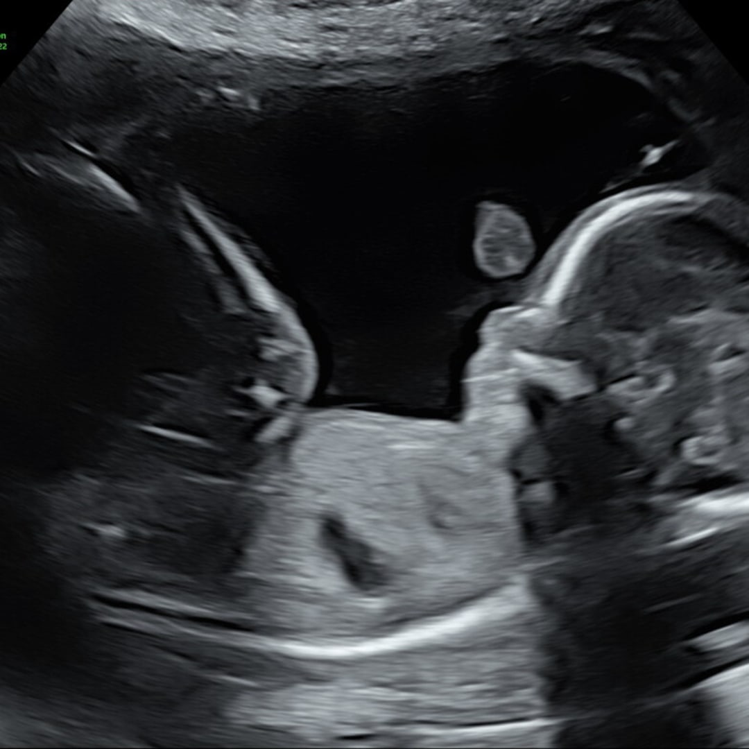 Photo shared by Chantal for their Babylist baby registry.