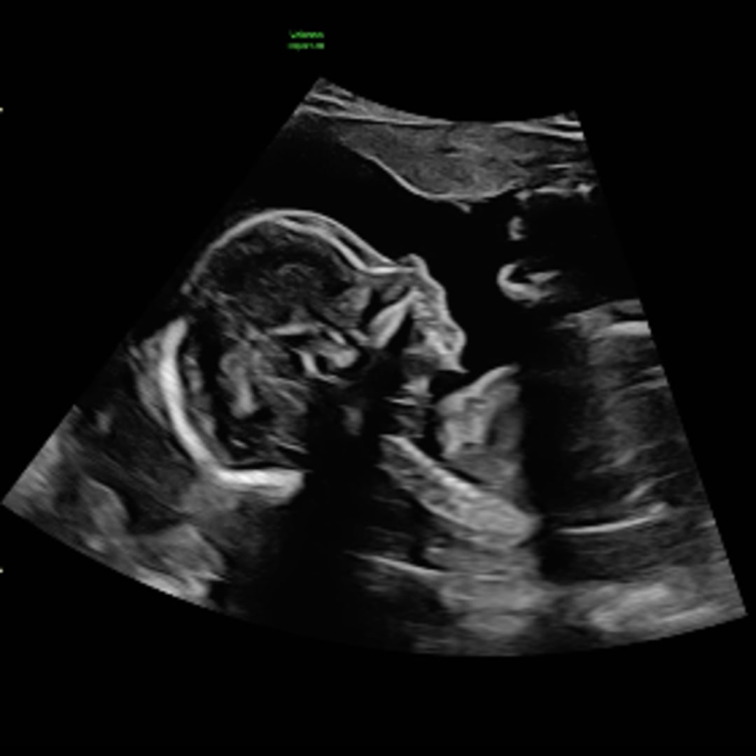 Photo shared by Julia for their Babylist baby registry.