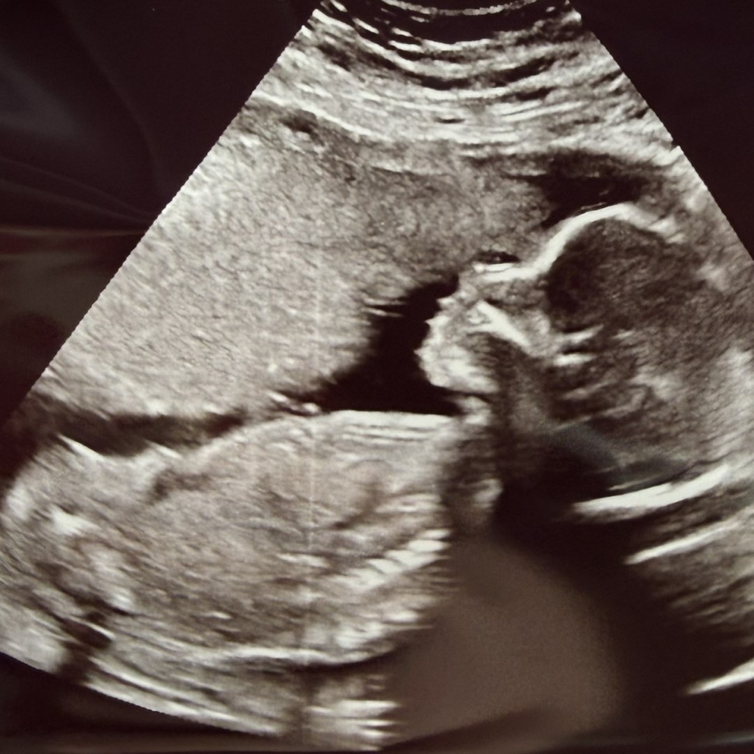 Photo shared by Marschel for their Babylist baby registry.