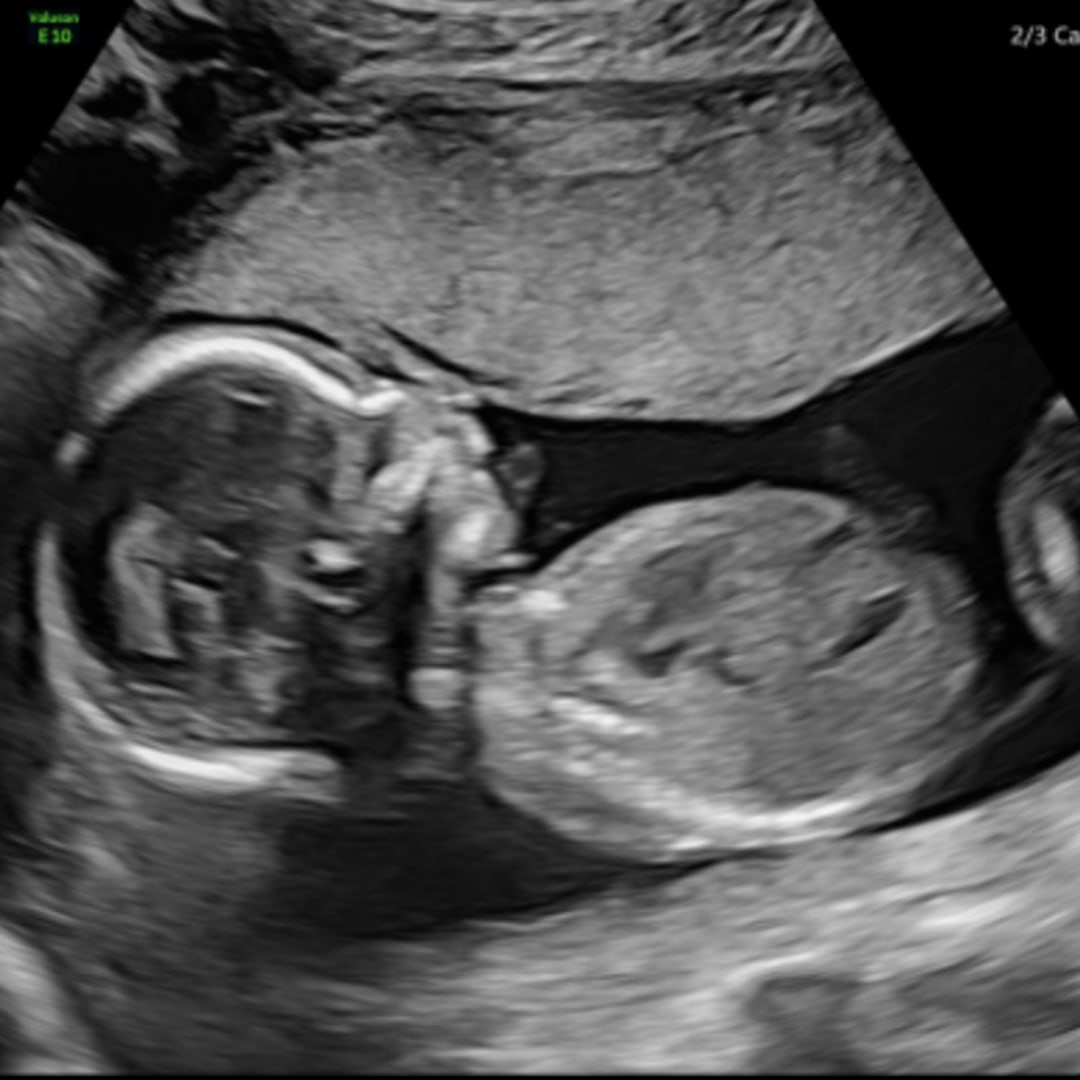 Photo shared by Olivia for their Babylist baby registry.