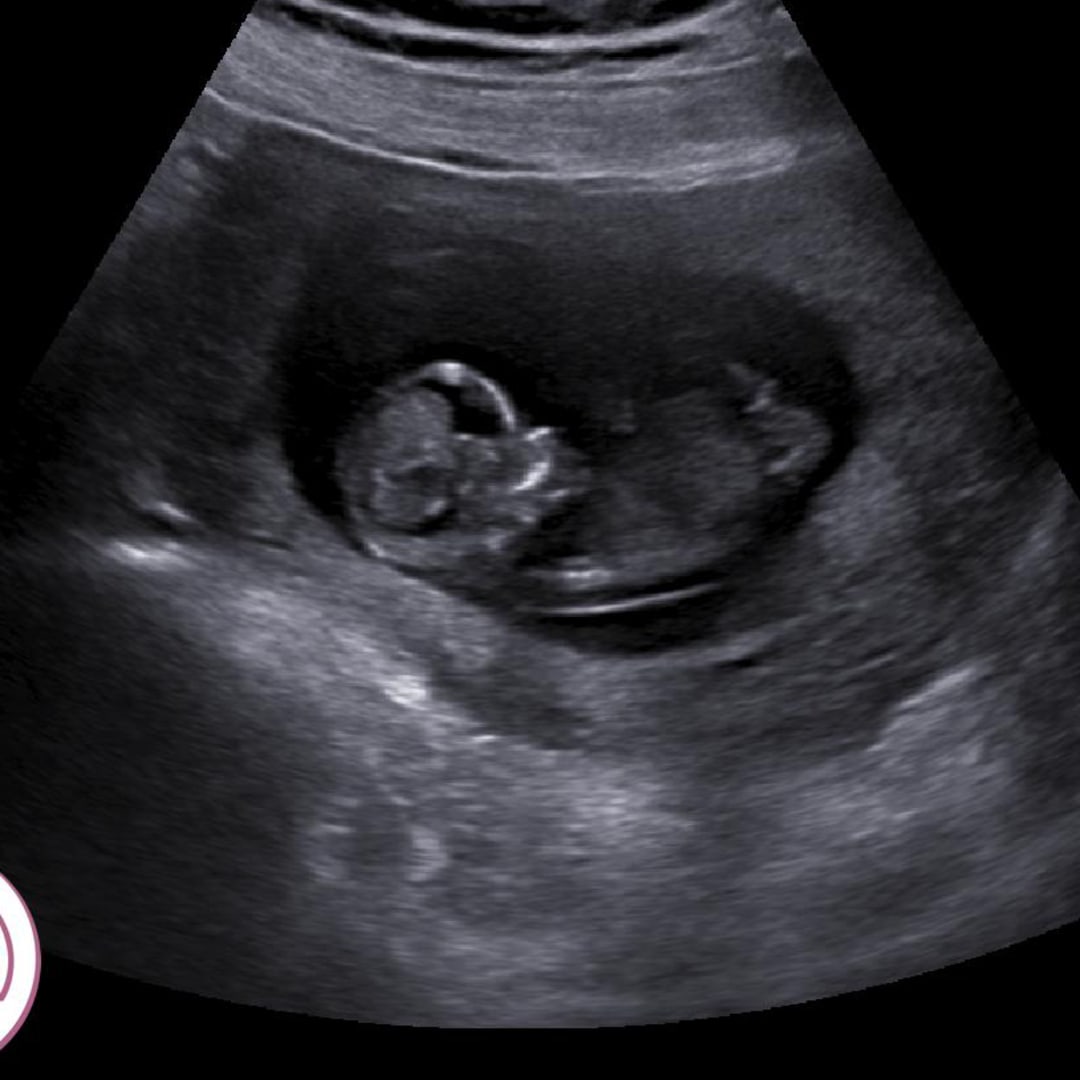 Photo shared by Kayley for their Babylist baby registry.