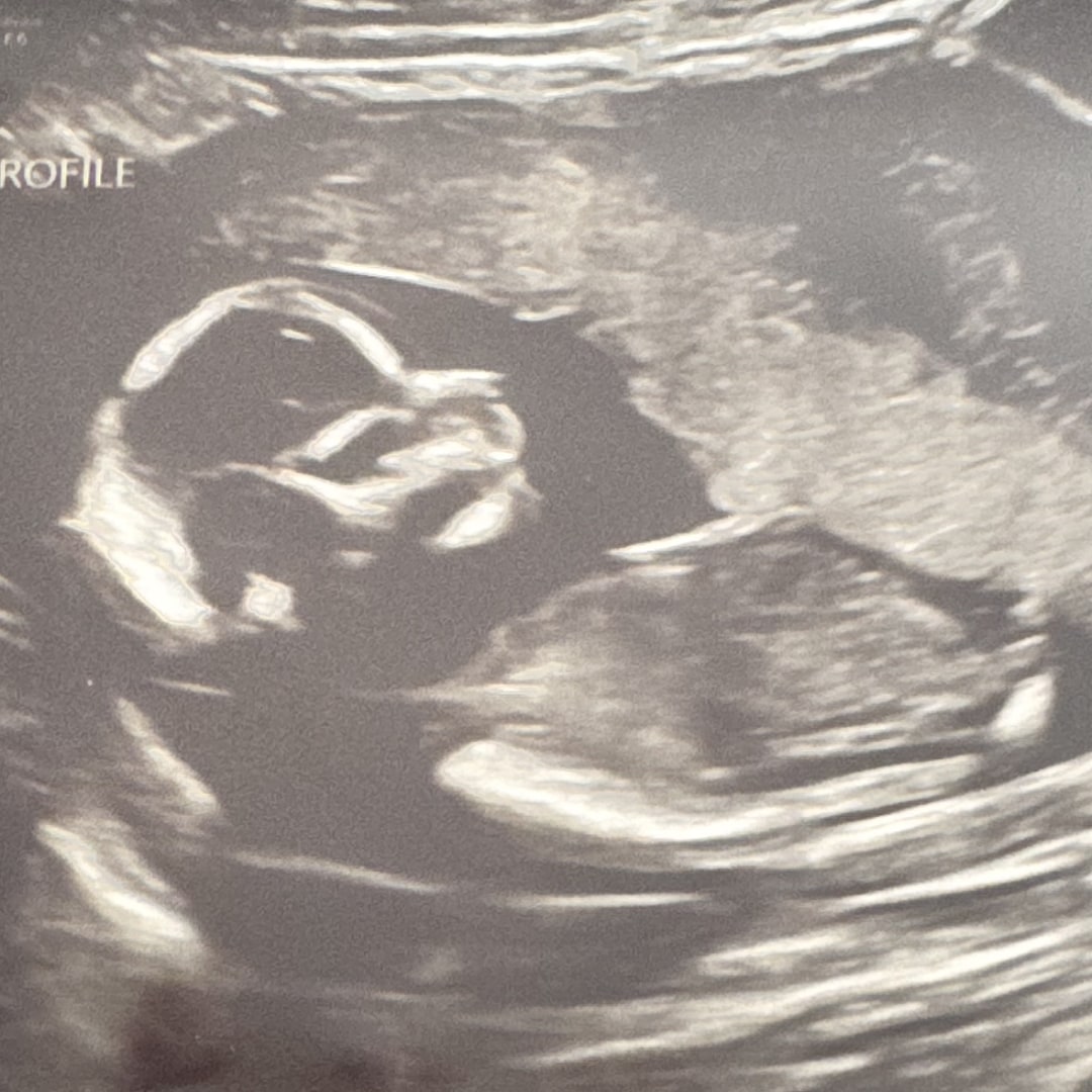 Photo shared by Shannon for their Babylist baby registry.