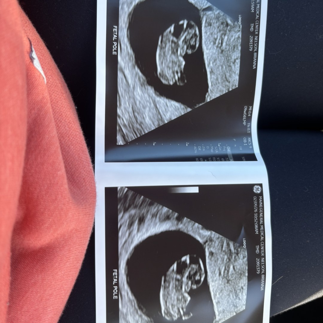 Photo shared by Brianna for their Babylist baby registry.