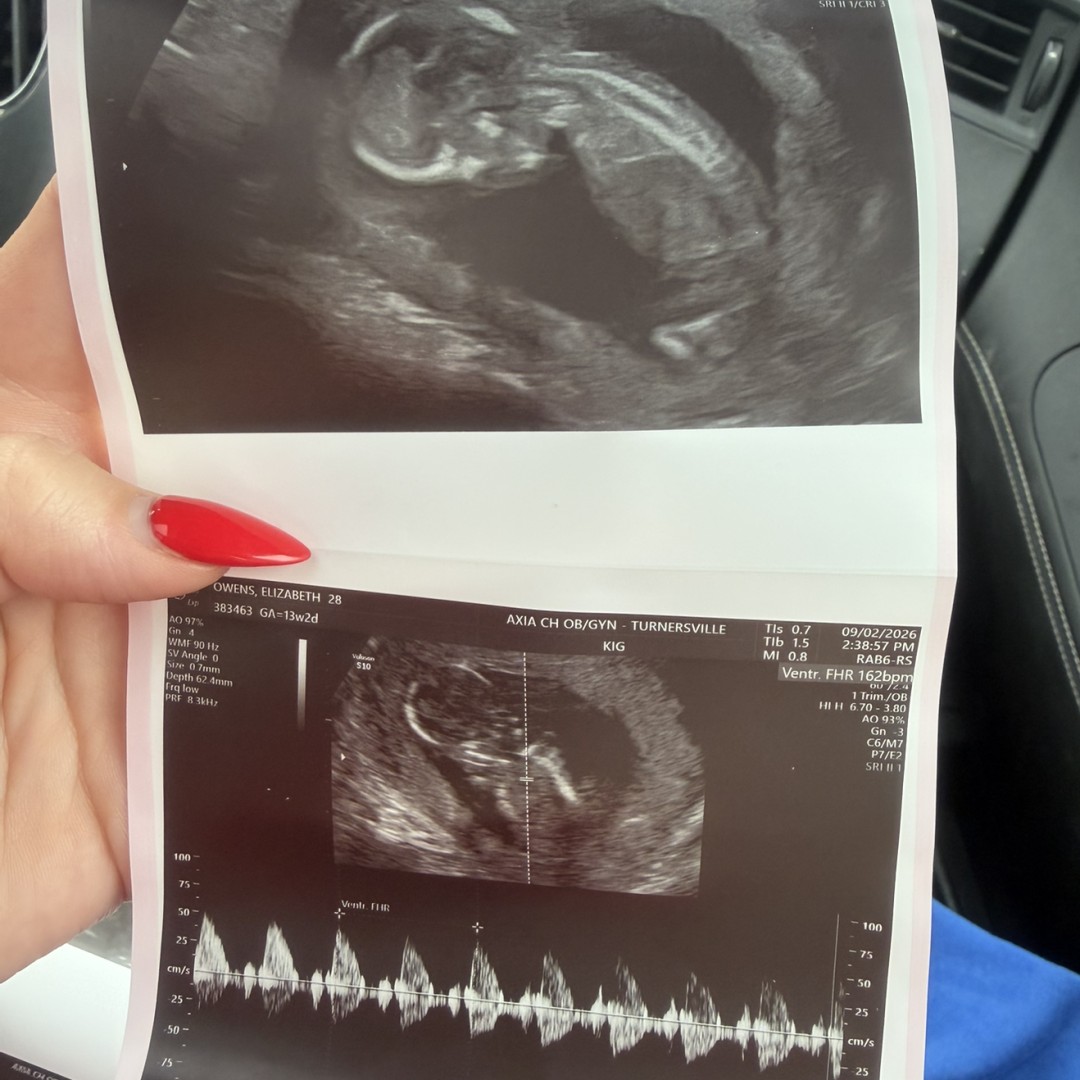 Photo shared by Lizzy for their Babylist baby registry.